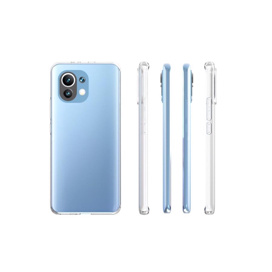 Xiaomi Mi 11 TPU Cover Clear